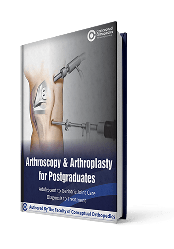 Arthroscopy-Arthroplasty-For-Postgraduates