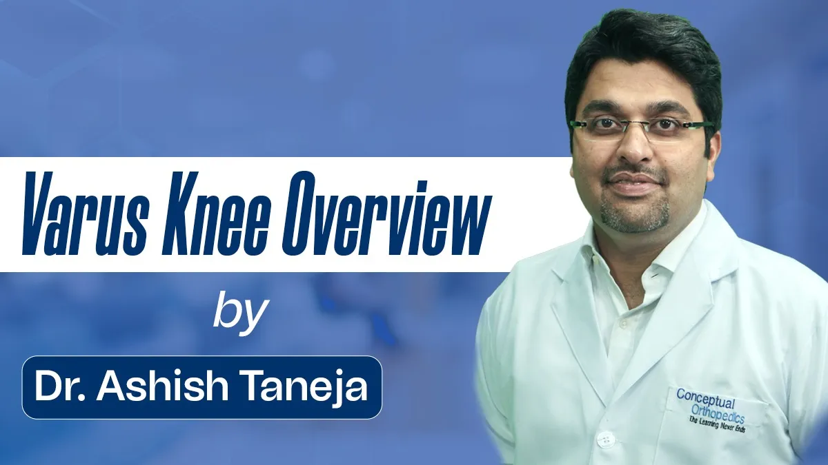 Varus Knee Overview by Dr. Ashish Taneja