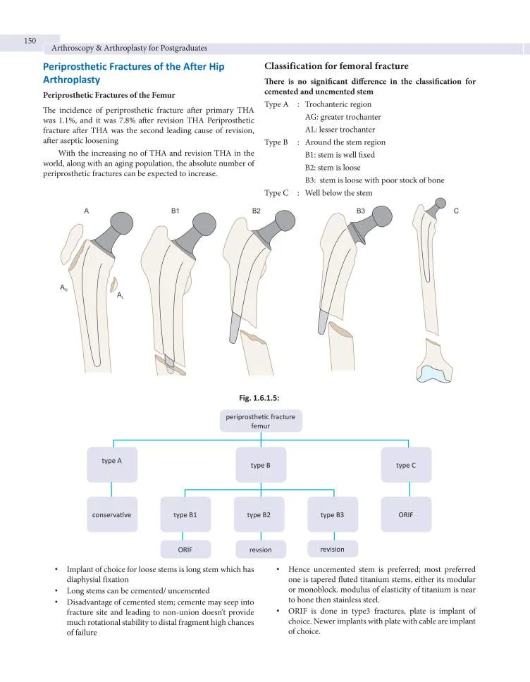 Arthroplasty-3