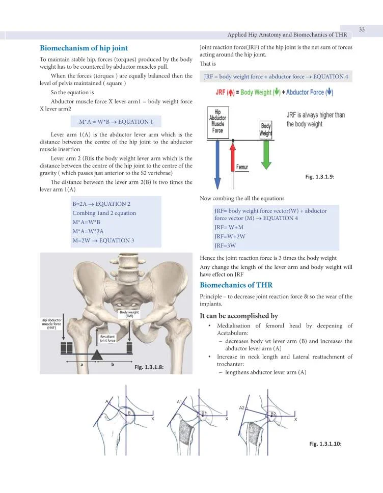 Arthroplasty-9