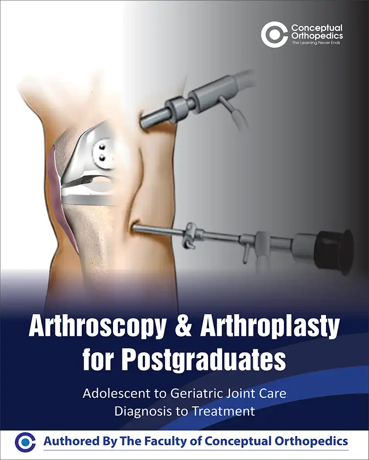 Arthroscopy-Arthroplasty-1